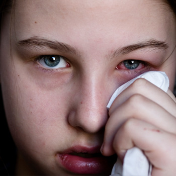 Causes, Symptoms and Treatment of Pink Eye