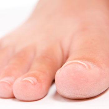 Nail Fungus – No Need To Keep Living With The Infection