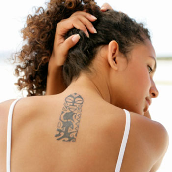 Tattoo Removal: What to Expect