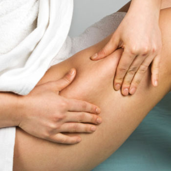 Cellulite: Just Plain Fat?